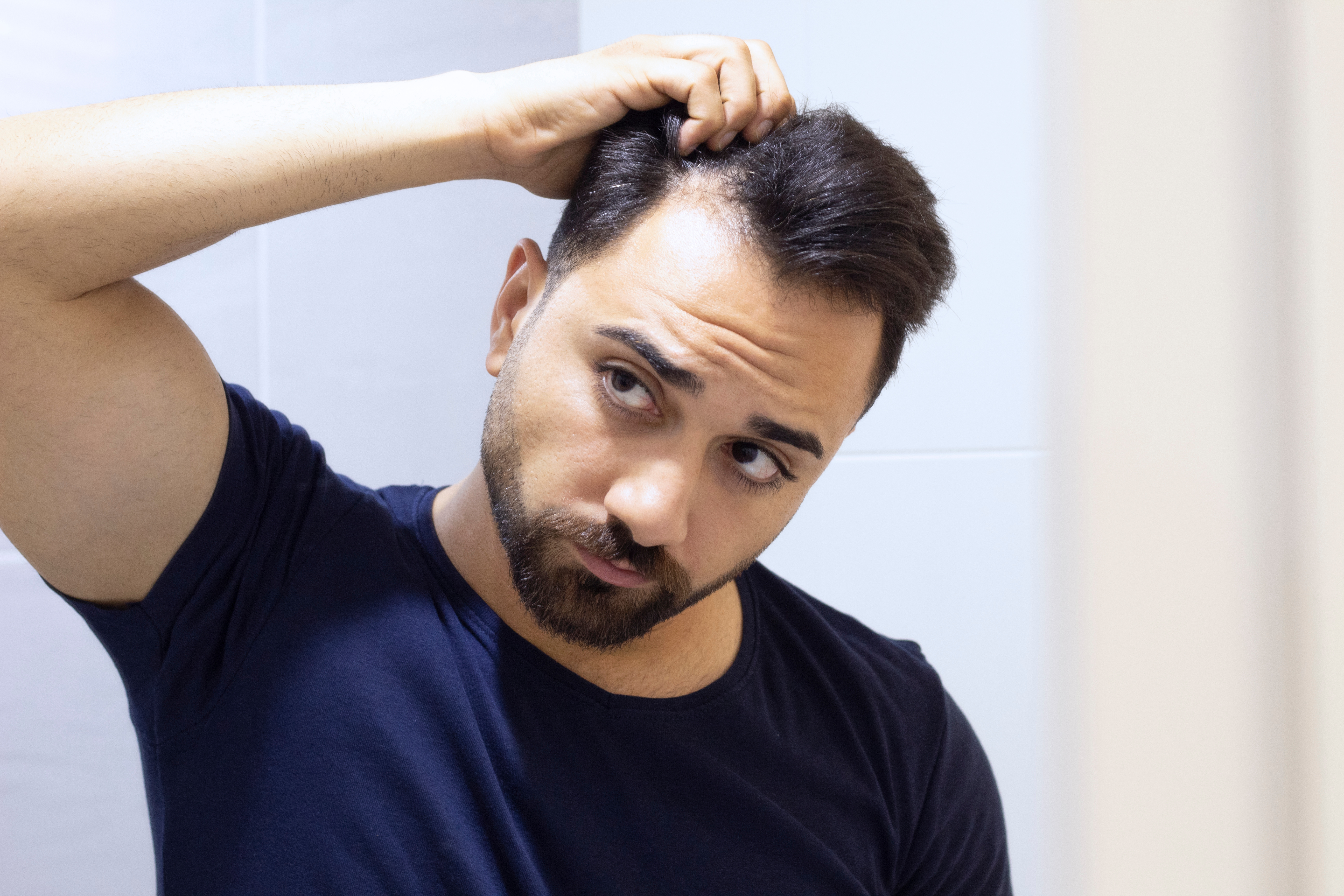 Hair Loss
