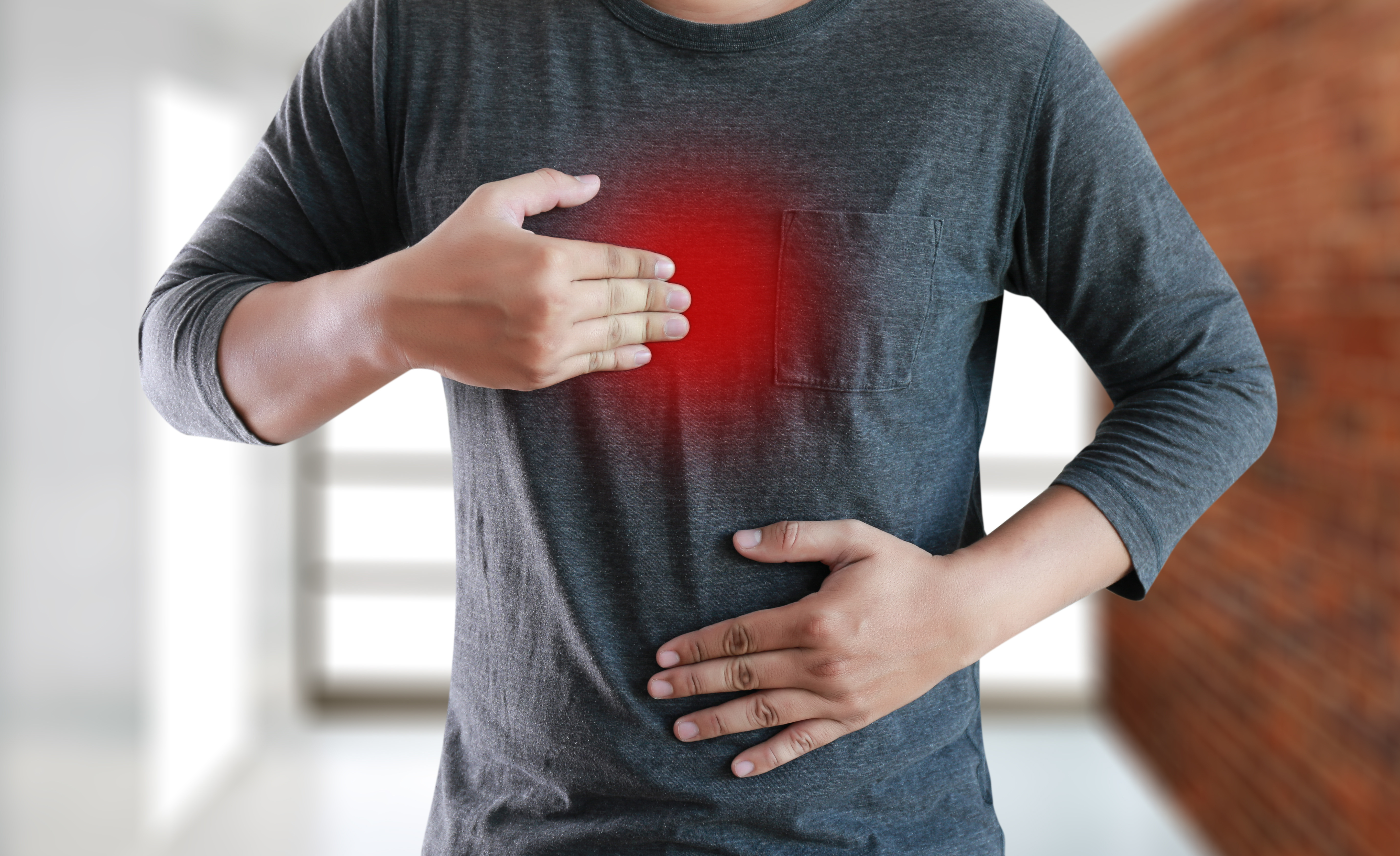 Acid Reflux